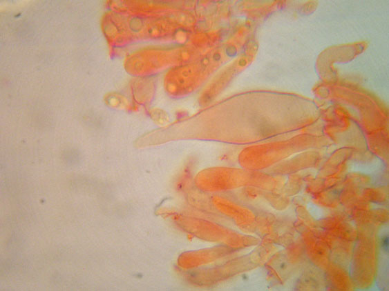 Raccolte del 9 Novembre