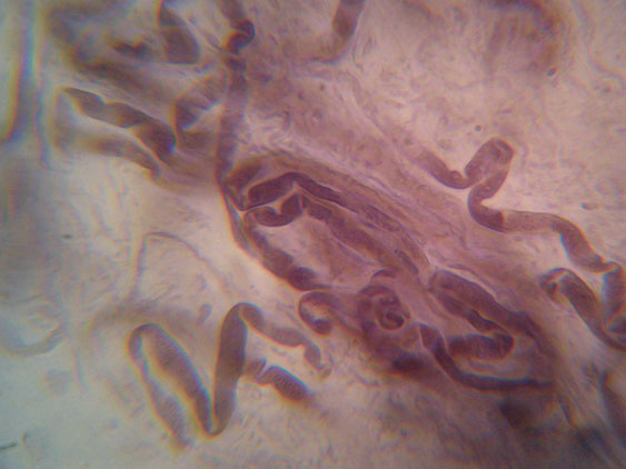 Gloiothele lactescens? (Gloiothele lactescens)