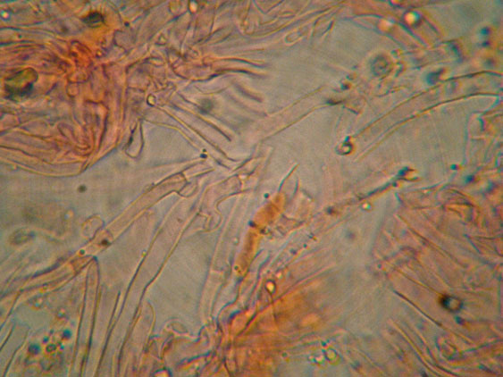 Da determinare (Ceraceomyces serpens)