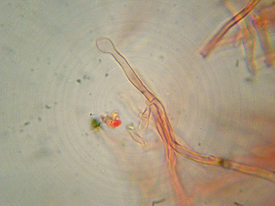 Aphyllophorales quiz (Schizopora flavipora)