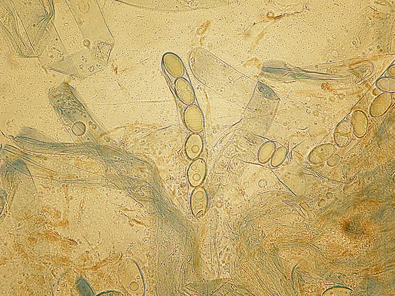 Pachyella lazzariana?