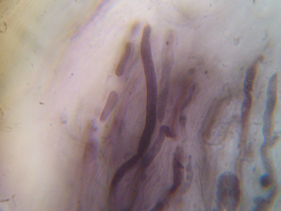 Gloiothele lactescens? (Gloiothele lactescens)