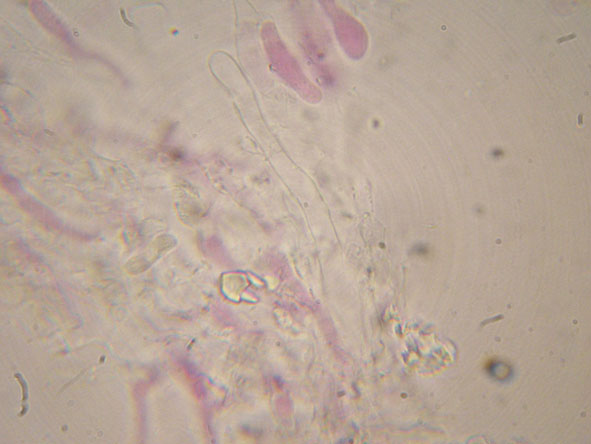 Hyphoderma roseocremeum? (Hyphoderma roseocremeum)