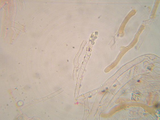Da determinare (Ceraceomyces serpens)