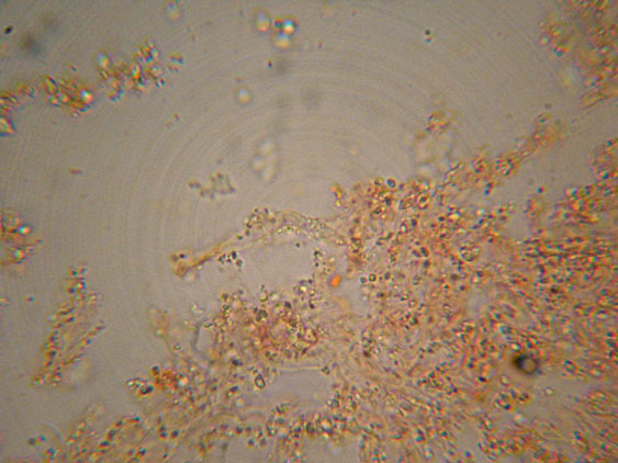 Piccola crosta su Ginestra (Hyphodontia juniper)