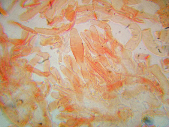 Crosticina con rizomorfe (Phanerochaete velutina)