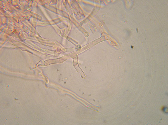 Mutatoderma mutatum
