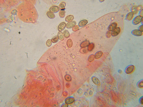 Raccolte del 30 e  31 Maggio