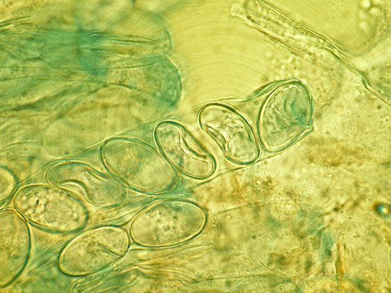 Pachyella lazzariana?