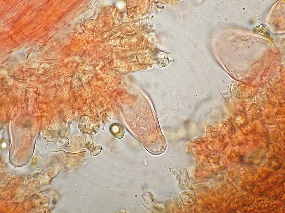 Inocybe da determinare