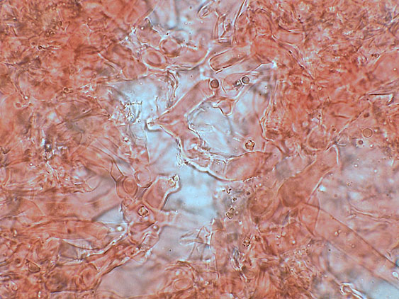 Rhizochaete radicata (Henn.) Gresl., Nakasone & Rajchenb.