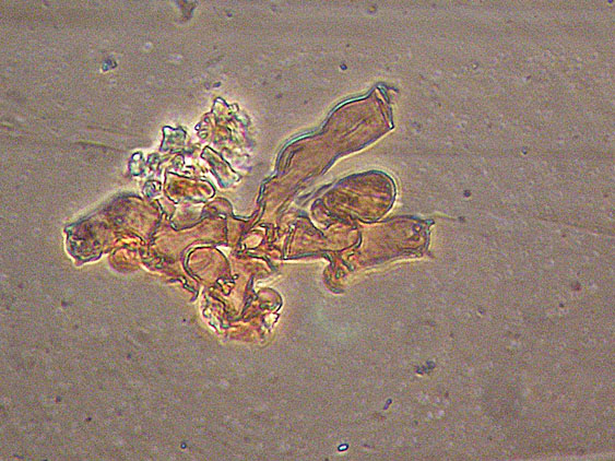 Botryobasidium subcoronatum