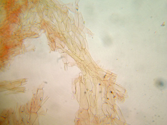 Da determinare (cfr. Callistosporium sp.)