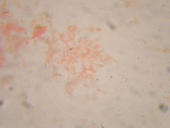 Raccolte del 9 Novembre