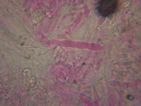 Hyphoderma roseocremeum? (Hyphoderma roseocremeum)