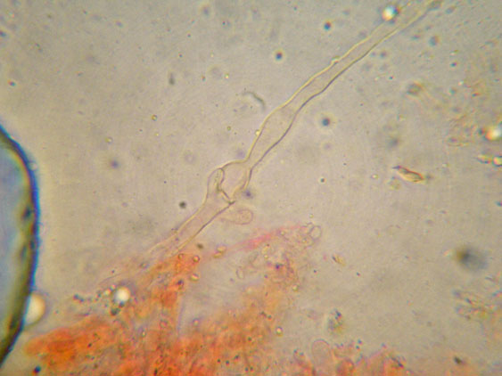 Da determinare (Ceraceomyces serpens)