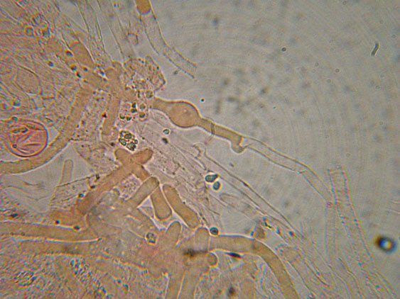 Da determinare (Ceraceomyces serpens)