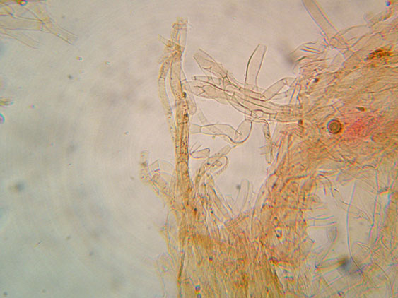 Da determinare (cfr. Callistosporium sp.)
