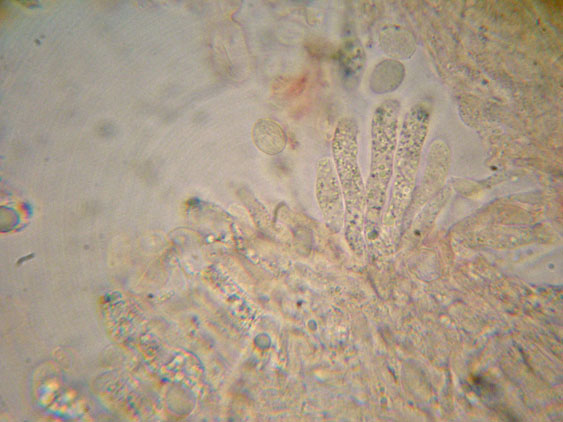 Radulomyces confluens
