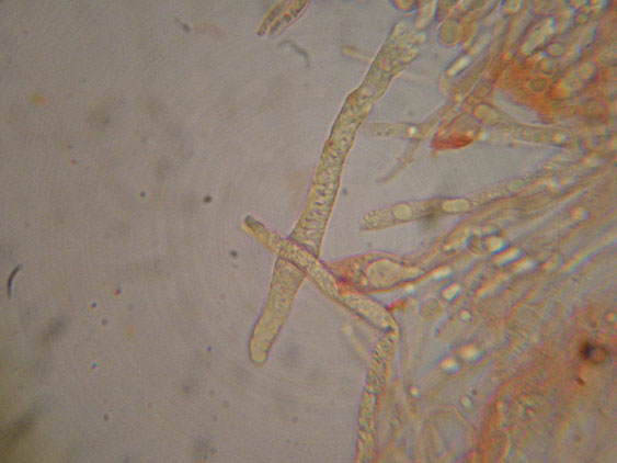 Gloiothele lactescens? (Gloiothele lactescens)