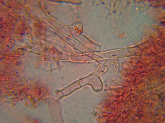 Phanerochaete raduloides? (Phanerochaete aculeata)