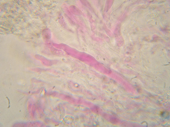 Hyphoderma roseocremeum? (Hyphoderma roseocremeum)