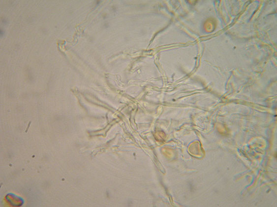 Altro lignicolo dalla Riserva Vomano (Perenniporia sp.)