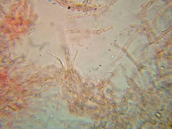 Basidioradulum crustosum