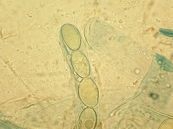 Pachyella lazzariana?