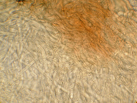 Quiz N.7 (Peniophora quercina)