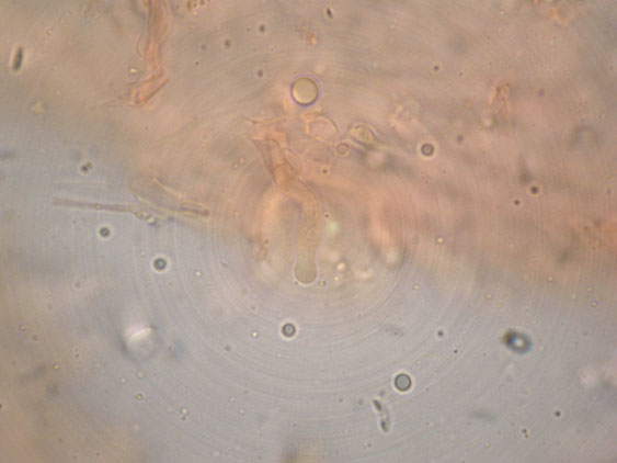 Curiosità più che determinaz.-foto6074(Postia leucomallella)