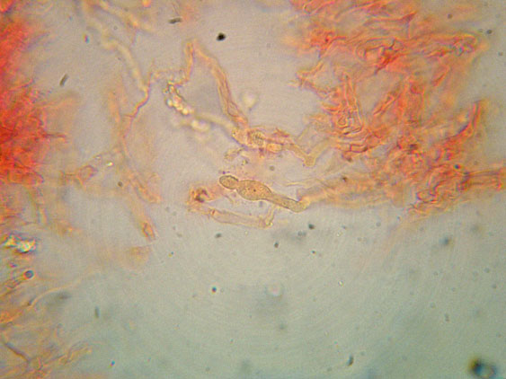 Basidioradulum crustosum