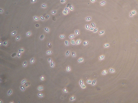 Rhizochaete radicata (Henn.) Gresl., Nakasone & Rajchenb.