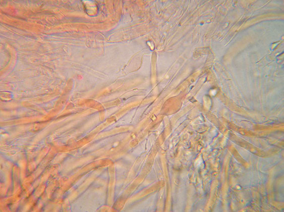 Da determinare (Ceraceomyces serpens)