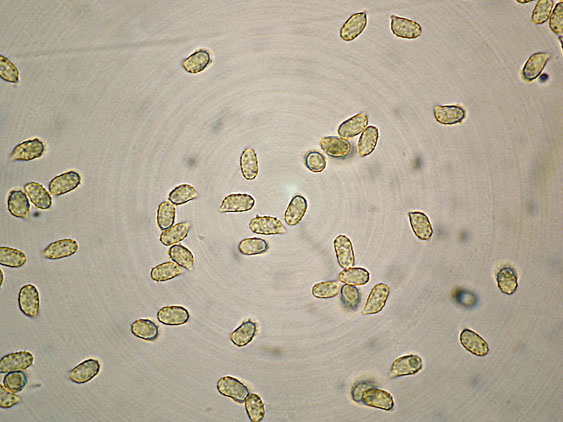 Ramaria da determinare