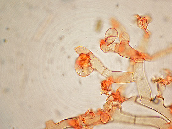 Botryobasidium da determinare