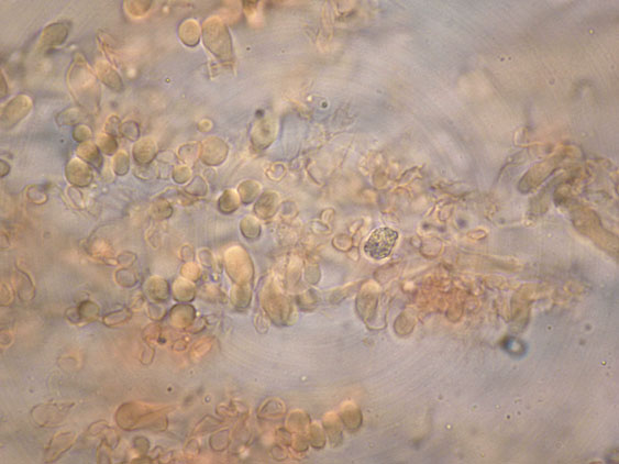 Curiosità più che determinaz.-foto6074(Postia leucomallella)