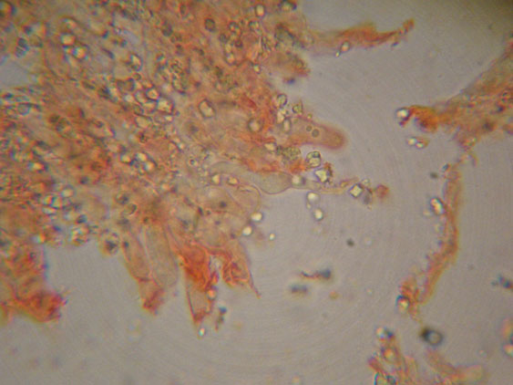 Piccola crosta su Ginestra (Hyphodontia juniper)
