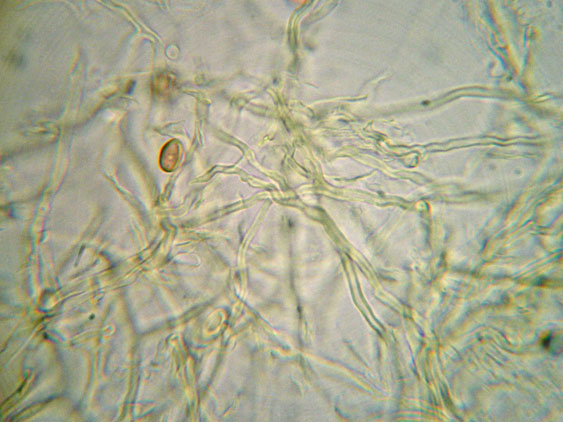 Altro lignicolo dalla Riserva Vomano (Perenniporia sp.)
