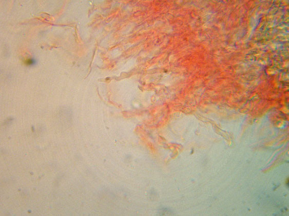 Basidioradulum crustosum