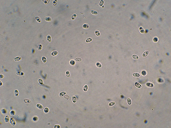 Rhizochaete radicata (Henn.) Gresl., Nakasone & Rajchenb.