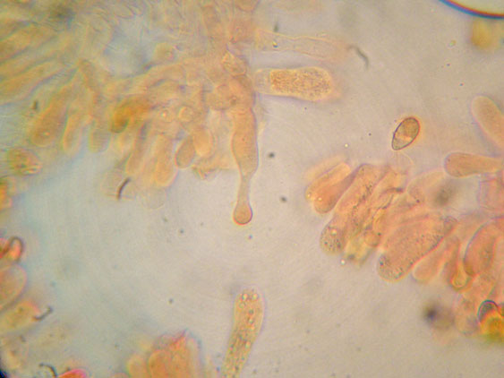 Raccolte del 9 Novembre