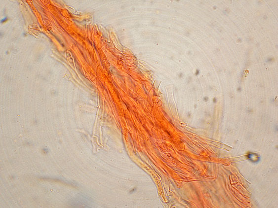 Ramaria da determinare