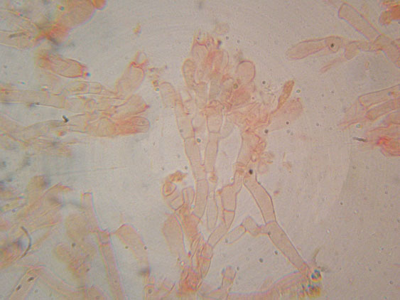 Da determinare (Athelia sp.)