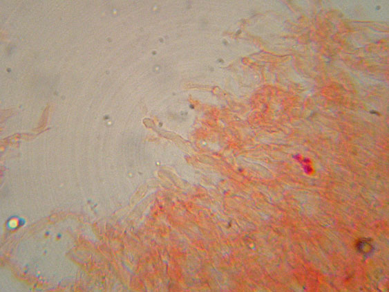 Basidioradulum crustosum