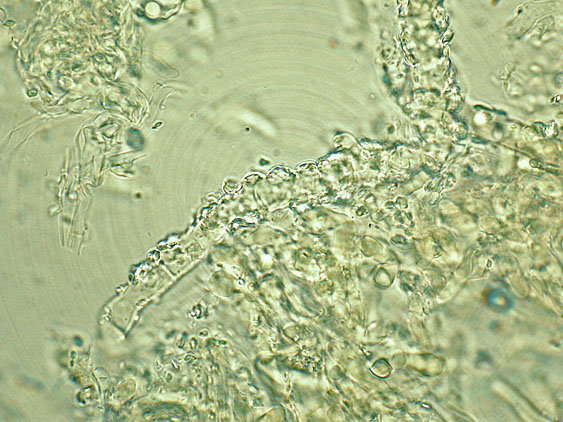Due croste forse una su abete-foto0555(Hyphoderma setigerum)