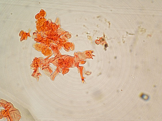 Botryobasidium subcoronatum (Höhn. & Litsch.)