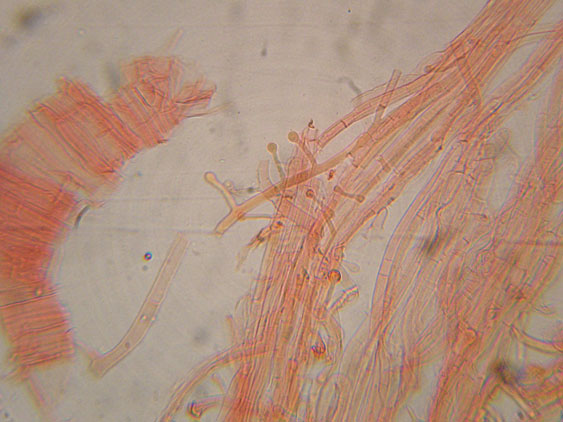 Raccolte del 9 Novembre