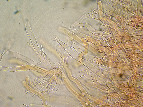 Quiz N. 6 (Oxyporus latemarginatus)