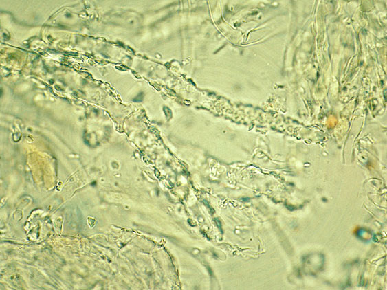 Due croste forse una su abete-foto0555(Hyphoderma setigerum)